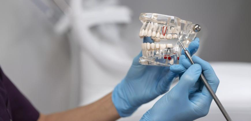 Кому подходит имплантация All-on-4 и All-on-6